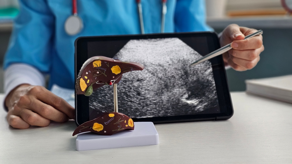 健檢都正常卻驗出「脂肪肝」？ 上班太操勞非患病主因！ 醫揭真相：泡芙人體質害慘肝臟