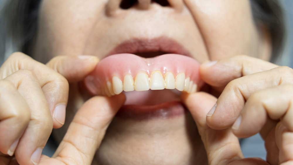 活動假牙總是黏不緊？ 醫揭真相：選對黏著劑，抹「一綠豆大」就能黏整天
