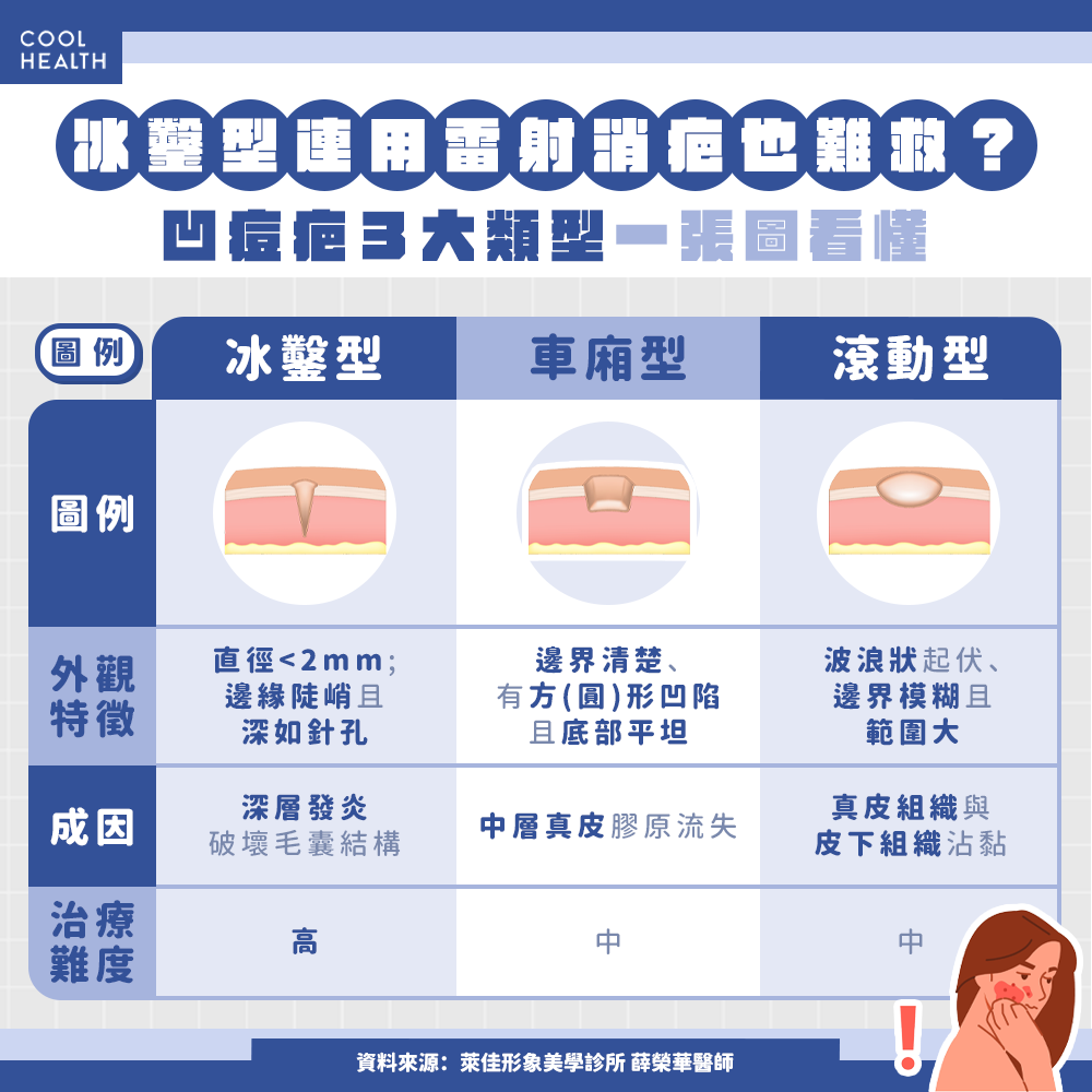 亂擠痘當心發生「二次損傷」！ 這種痘痘用雷射也難救？