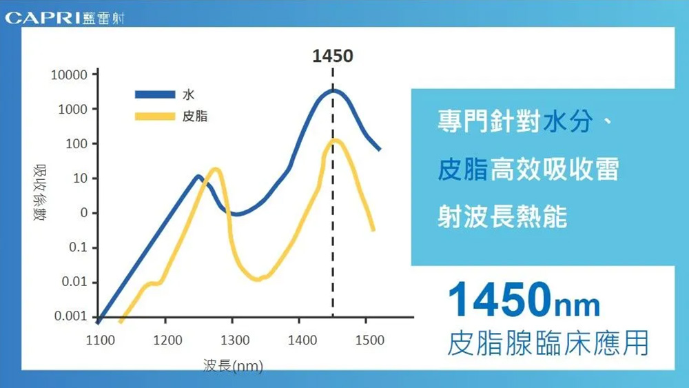 CAPRI藍雷射技術發展：非侵入式光電應用於眼瞼黃斑瘤相關外觀處理
