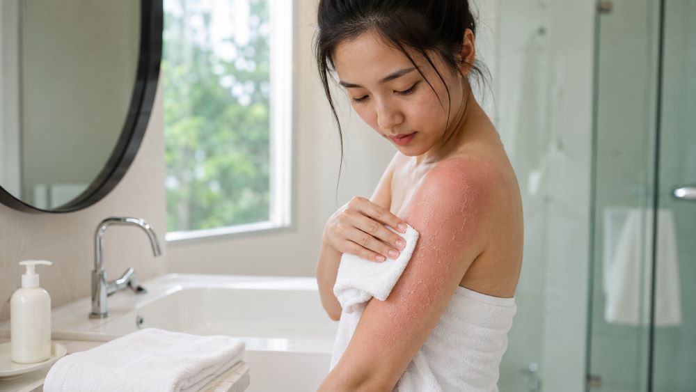曬傷怎麼辦？皮膚發紅、脫皮先別急著美白，曬傷處理重點曝光