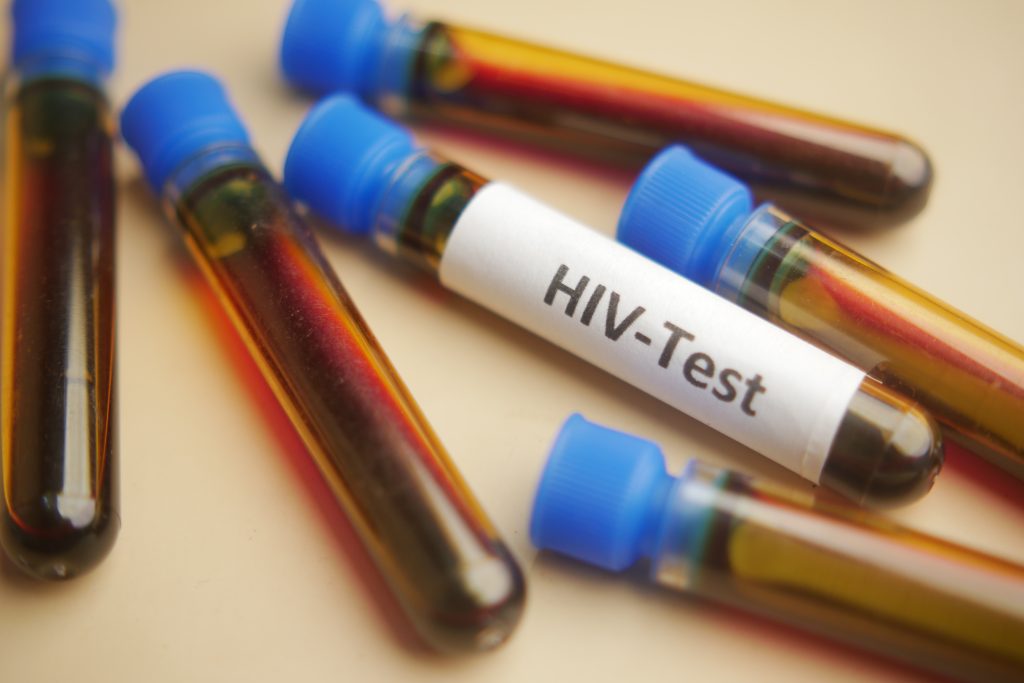 HIV 如何傳播？  握手、擁抱會造成感染嗎？
