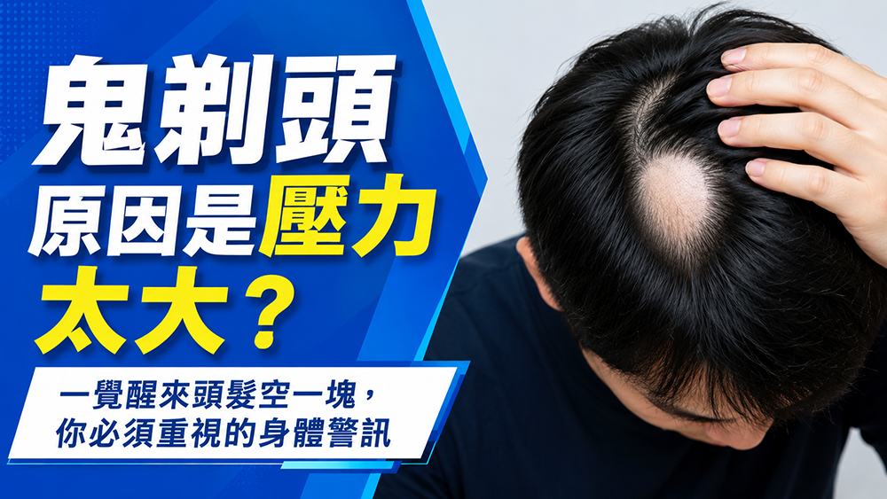 鬼剃頭一定是壓力太大嗎？醫師解析圓形禿原因與就醫警訊