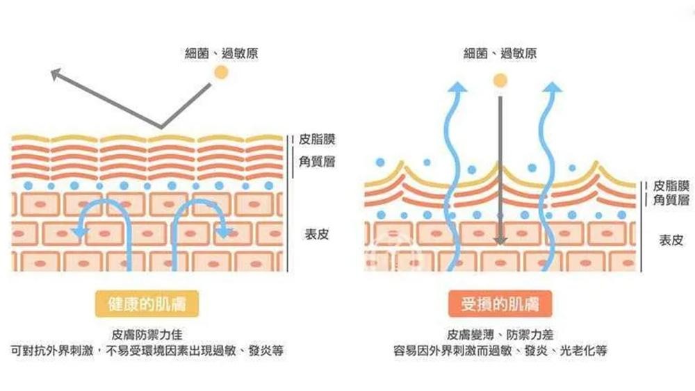 肝斑反覆出現怎麼辦？認識肝斑形成原因與肌膚修護新觀念