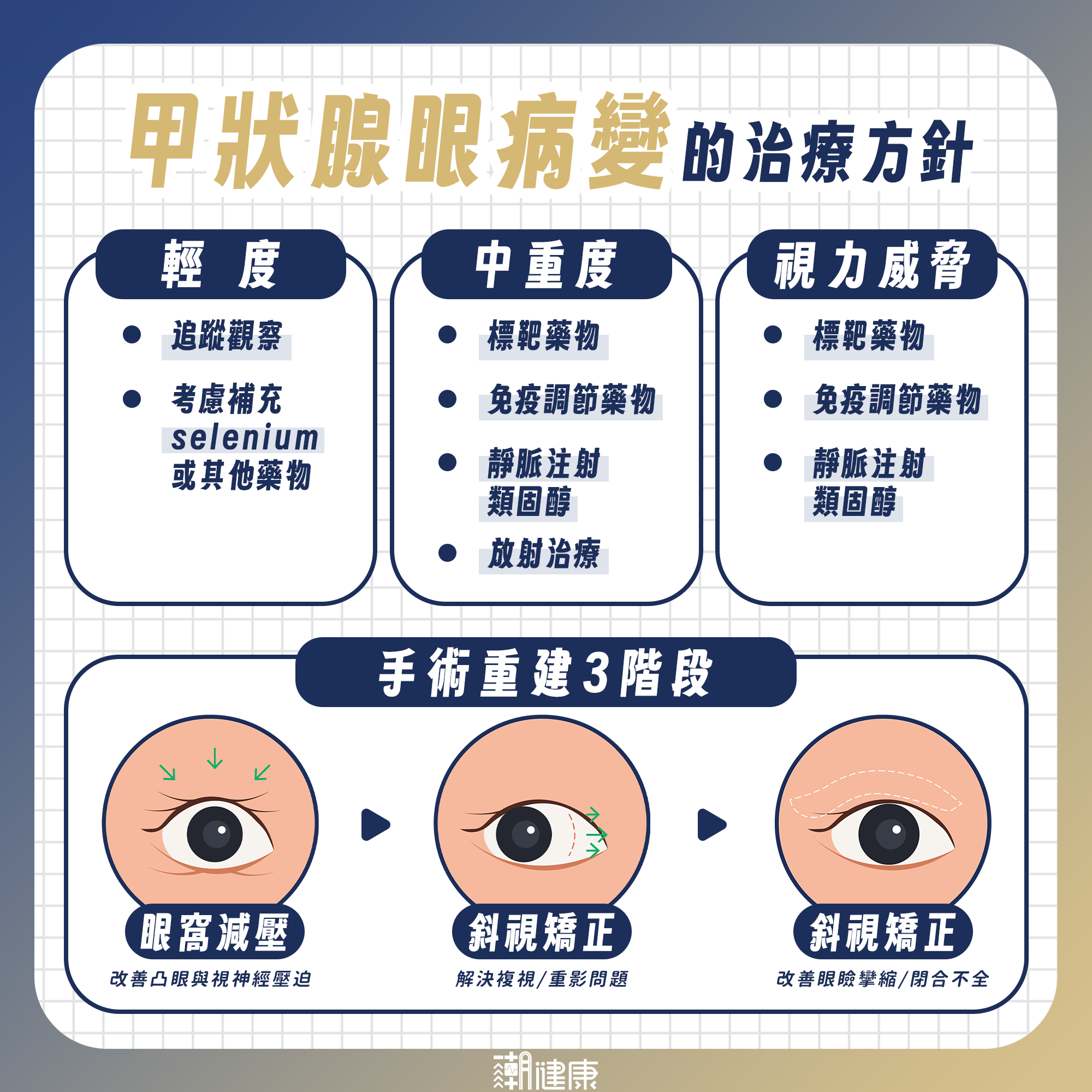 甲狀腺功能正常也可能罹病？ 專家示警：「凸眼、視野重疊」恐是甲狀腺眼病變 內文圖片 2