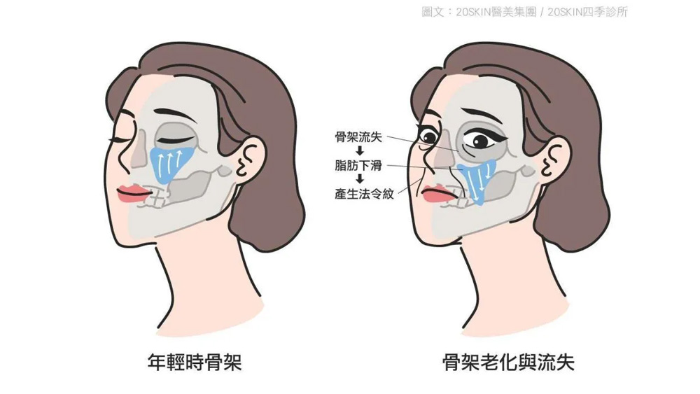 法令紋為什麼越來越明顯？從骨骼、軟組織到表情活動認識常見成因
