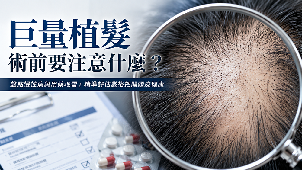 巨量植髮術前要注意什麼？盤點慢性病、用藥與生活習慣等評估重點