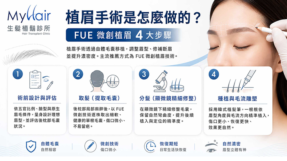 眉毛稀疏、斷眉怎麼辦？認識植眉手術四大步驟與術前評估重點