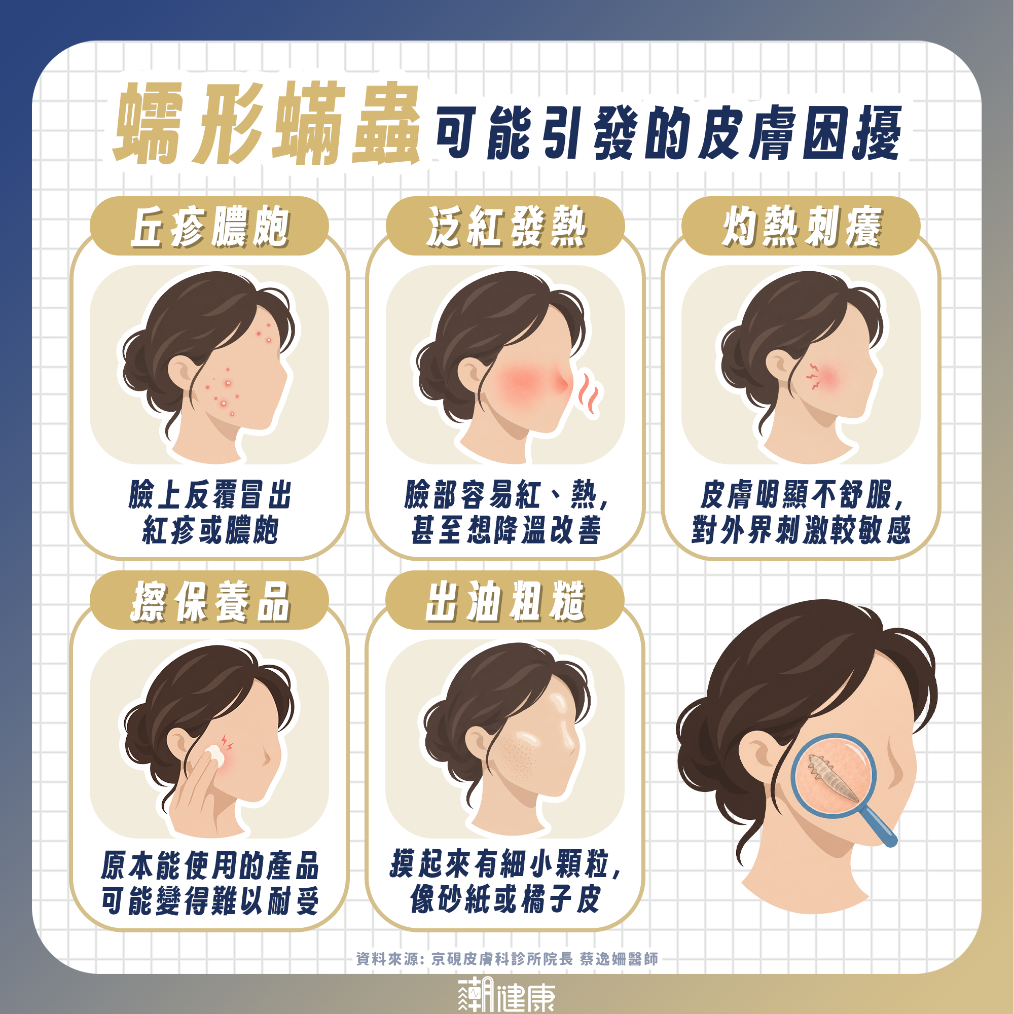 臉上驗出蠕形蟎蟲怎麼辦？ 醫揭玫瑰斑治療真相：目標在「改善症狀」而非清零 內文圖片 1