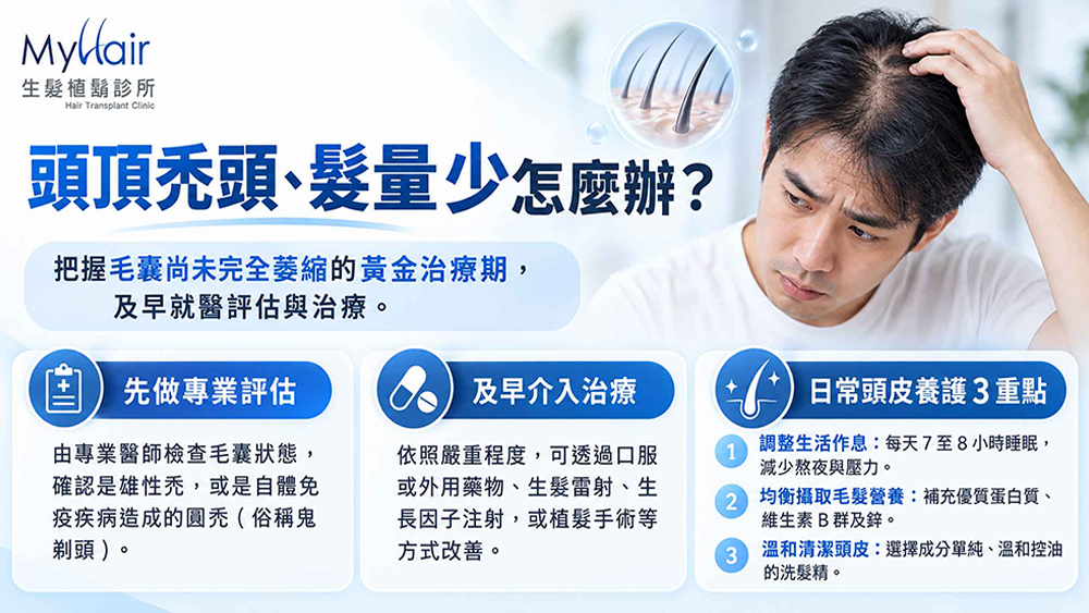 頭頂禿頭怎麼辦？醫師解析常見落髮原因、就醫評估與日常照護重點