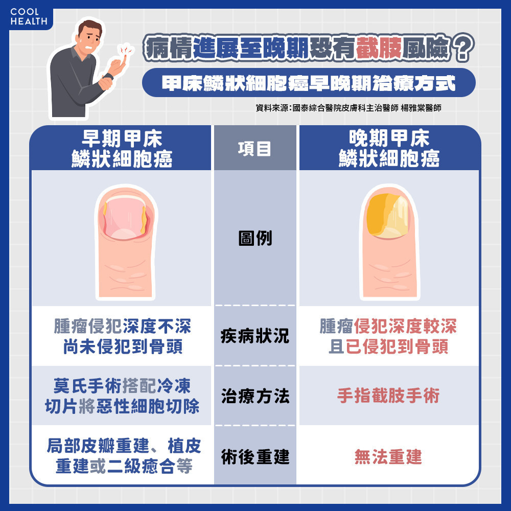 甲床鱗狀細胞癌如何治療？ 醫示警：晚期恐需切除整根手指