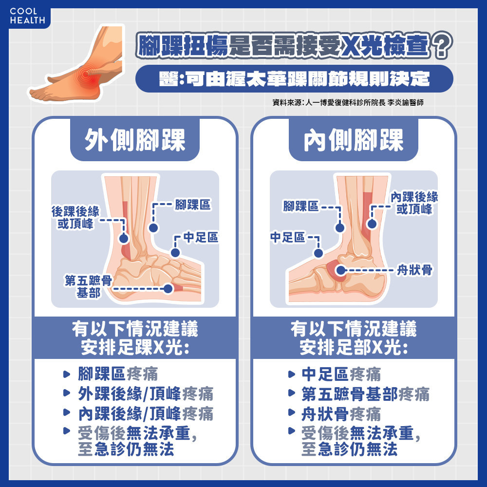 「檢測陽性」不代表有骨折？ 醫曝：受傷後「無法承重」要注意！