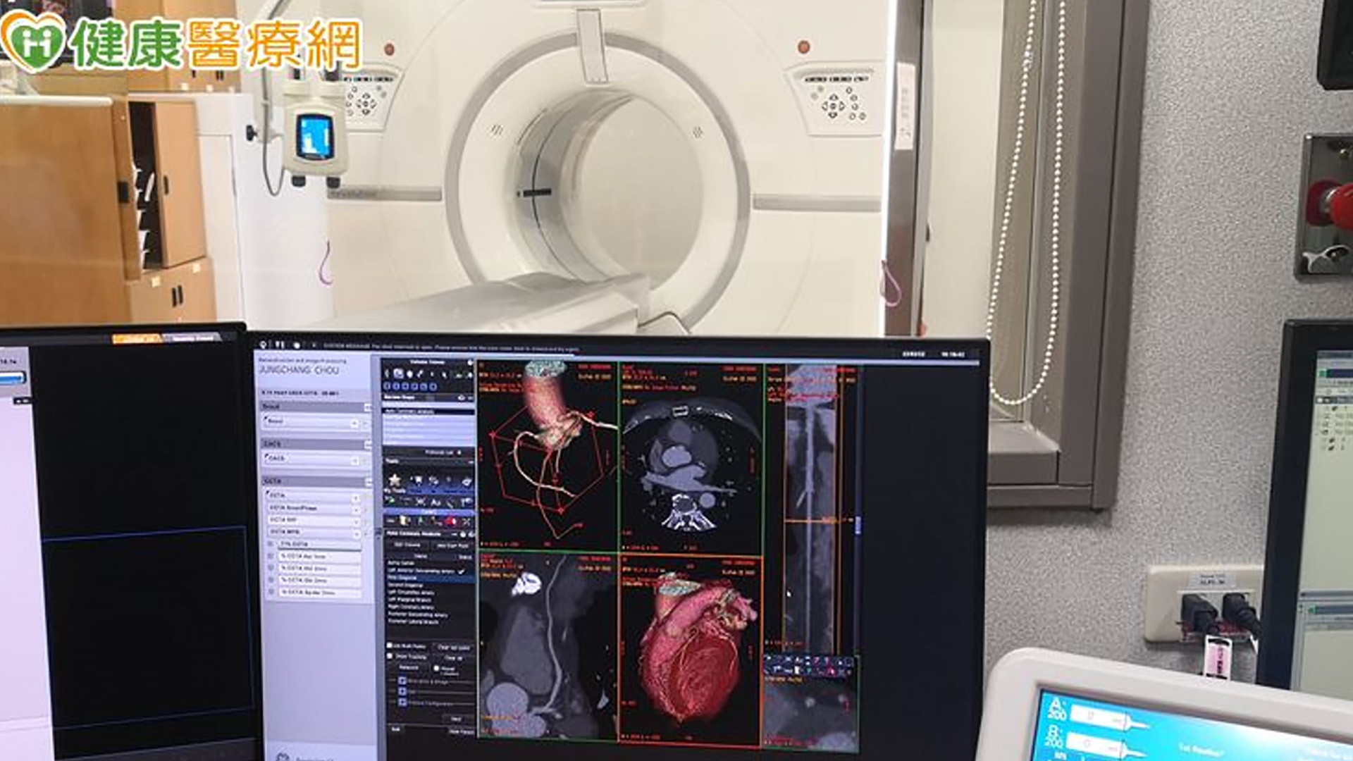 一旦發生阻塞性CAD或心肌缺血或梗塞，將接續負擔龐大醫療費用，因此CAD早期偵測、預防和治療為現今各國重要課題。