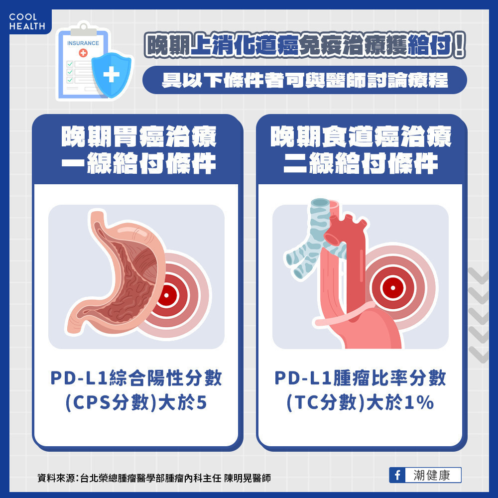 晚期上消化道癌免疫治療獲給付！ 具「這2條件」快與醫師討論療程