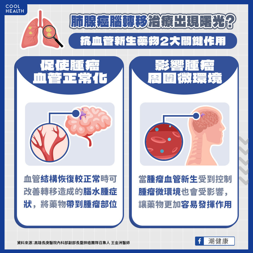 肺腺癌腦轉移「抗血管新生藥物」  突破血腦屏障難關提升藥物濃度