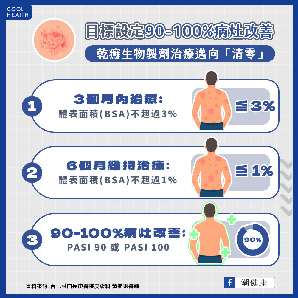 中重度乾癬治療困境？  生物製劑助攻朝「清零」前進