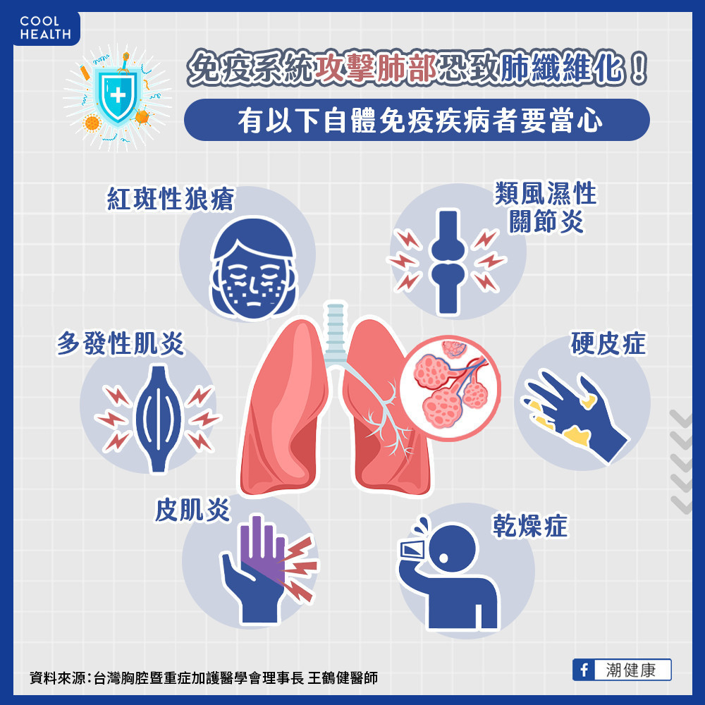 自體免疫疾病更要當心肺纖維化  每3-6月應檢測肺功能