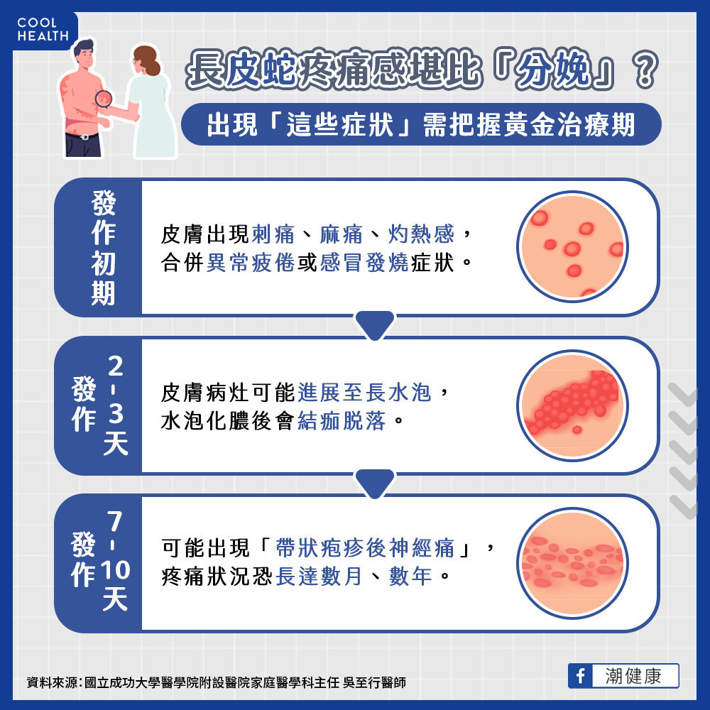 打嗎啡也無法完全緩解？ 「帶狀疱疹後神經痛」恐比分娩還痛