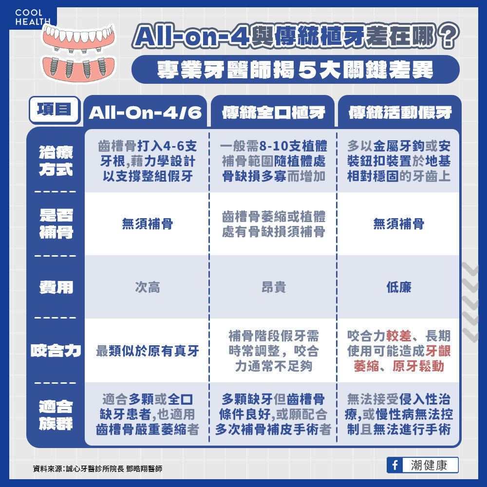 固定式全口重建分為哪些項目？ 「All on 4」與傳統植牙差在哪？