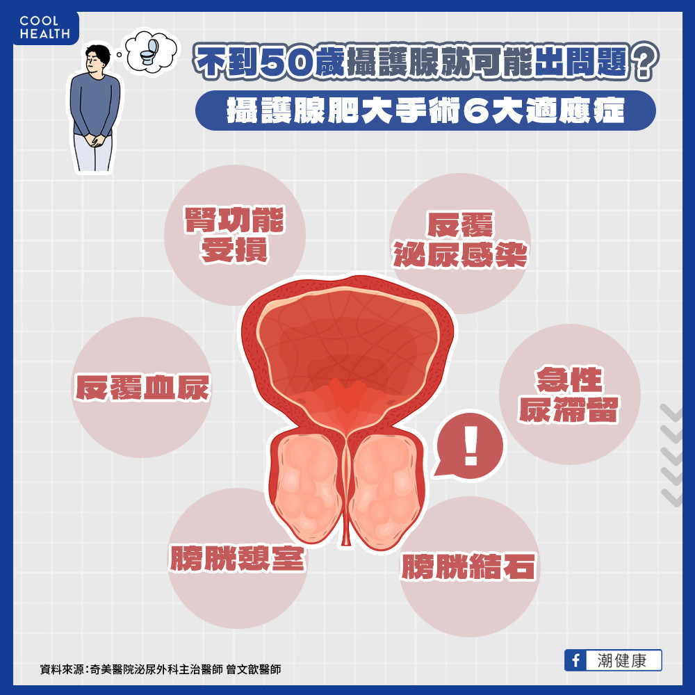 不到50歲就攝護腺肥大！  他每晚尿4次治療後回到20歲