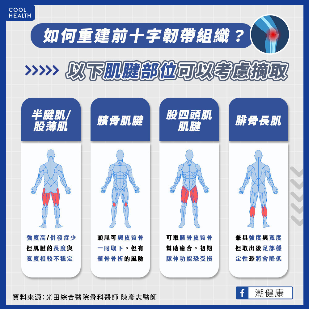 如何重建前十字韌帶組織？  哪些肌腱部位可以考慮摘取？