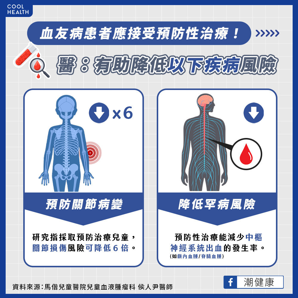 接受預防性治療  兒童病友關節損傷風險降6倍