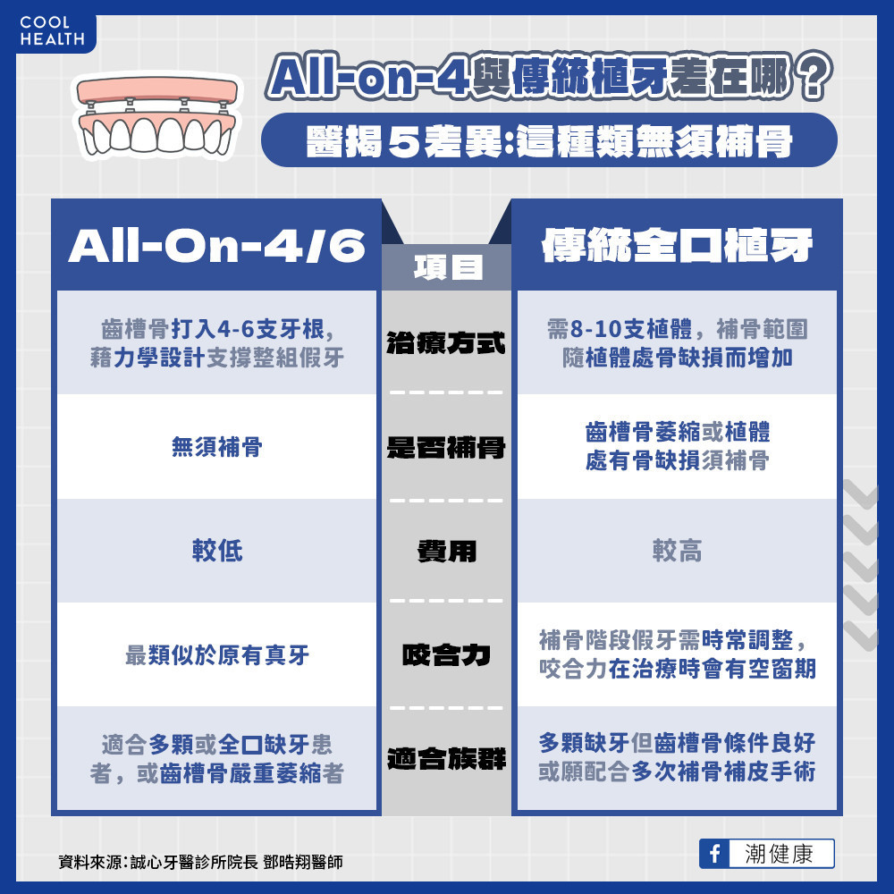 「All-on-4」與傳統植牙差異？ 不用補骨也能進行手術？