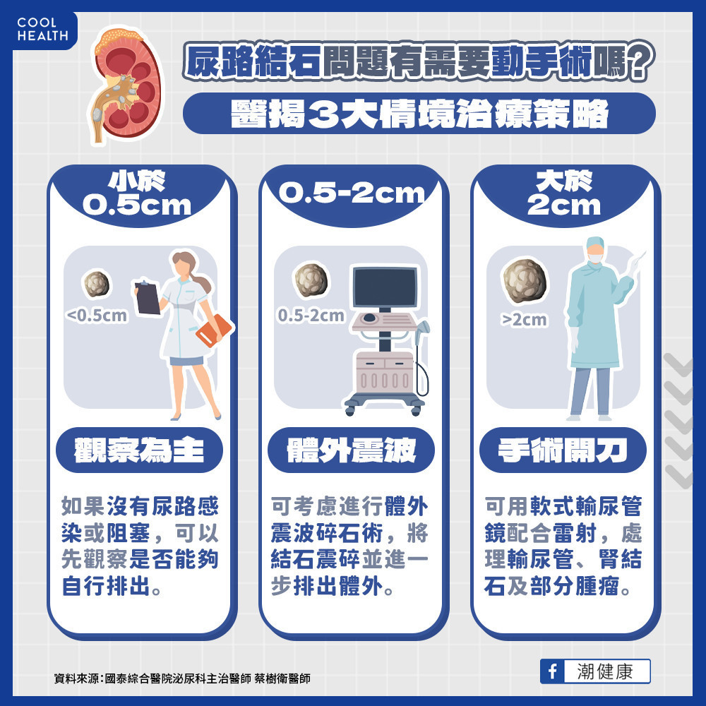 尿路結石問題有需要動手術嗎？  醫揭3大情境治療策略