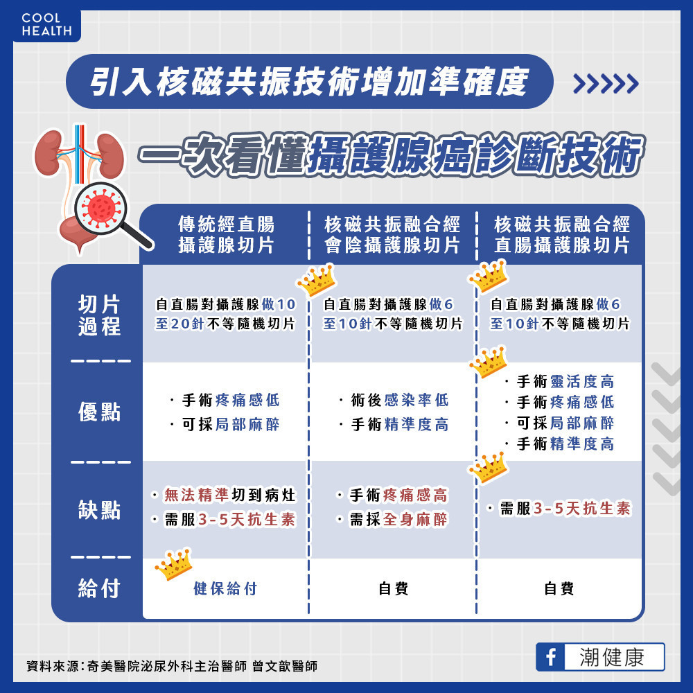 導入核磁共振技術增加準確度  一次看懂攝護腺癌診斷技術