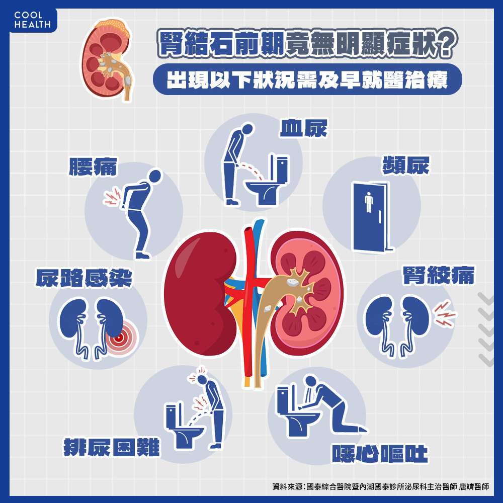 泌尿道結石未必有症狀  恐引發慢性感染影響腎功能