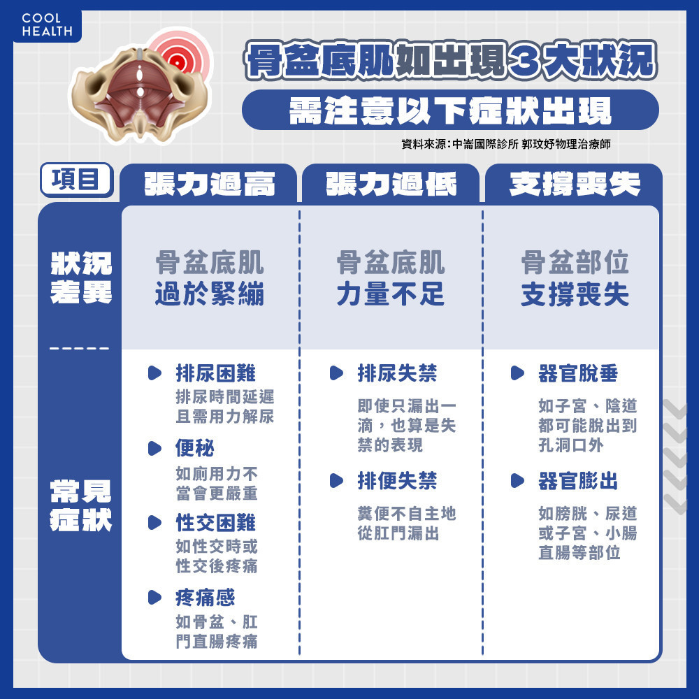 強化骨盆底肌的最佳解方！ 學好凱格爾運動還能增加情趣？