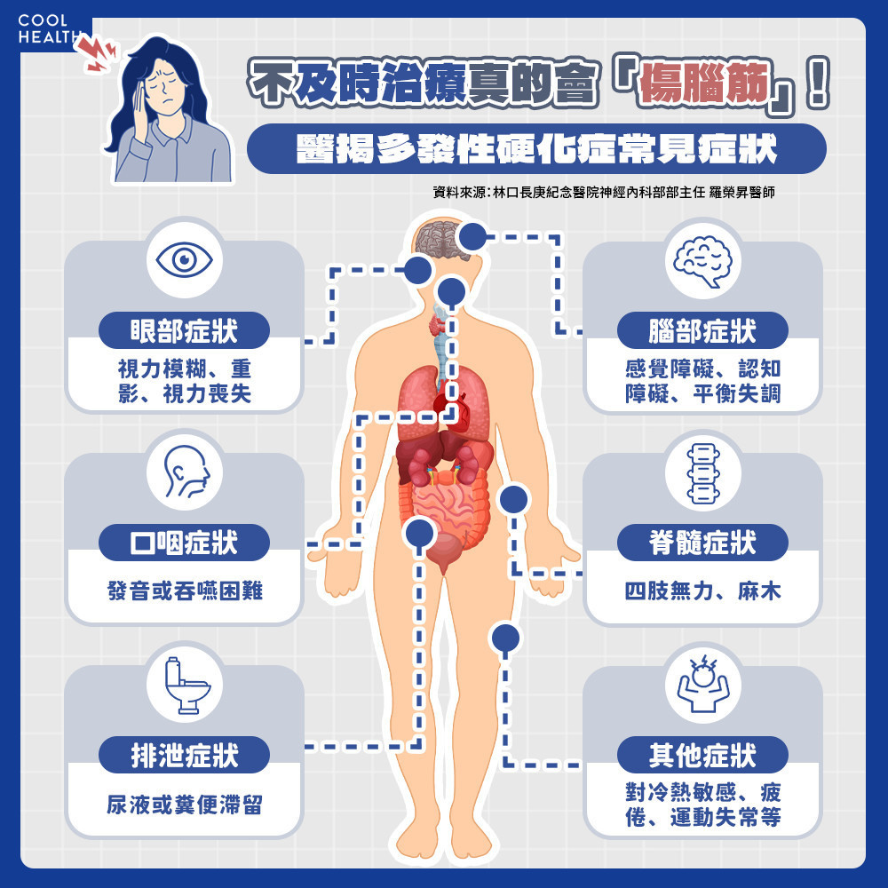 不治療真的會「傷腦筋」！ 醫揭多發性硬化症常見症狀