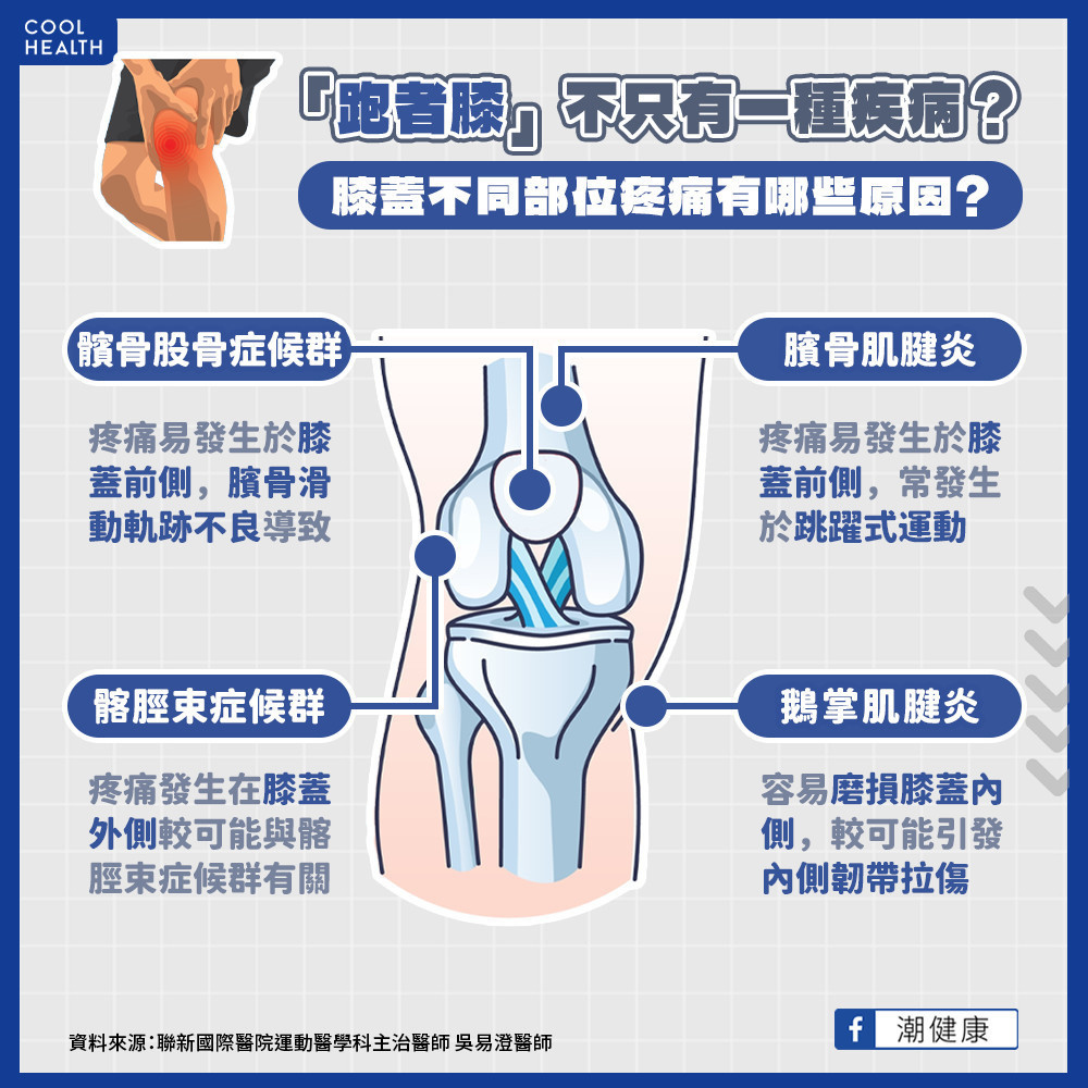 「跑者膝」不只一種疾病？  膝蓋疼痛有哪些原因