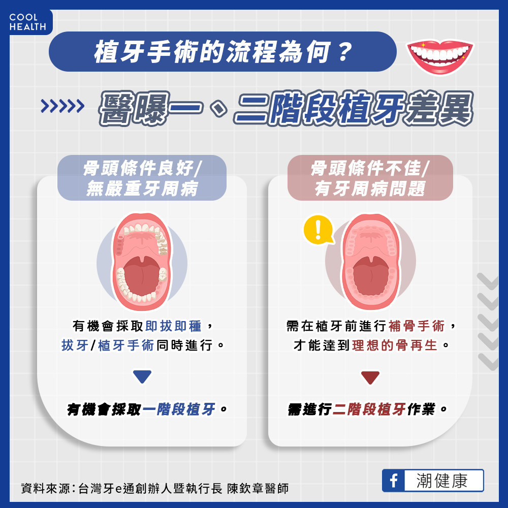 植牙手術的流程？  手術前後注意事項？