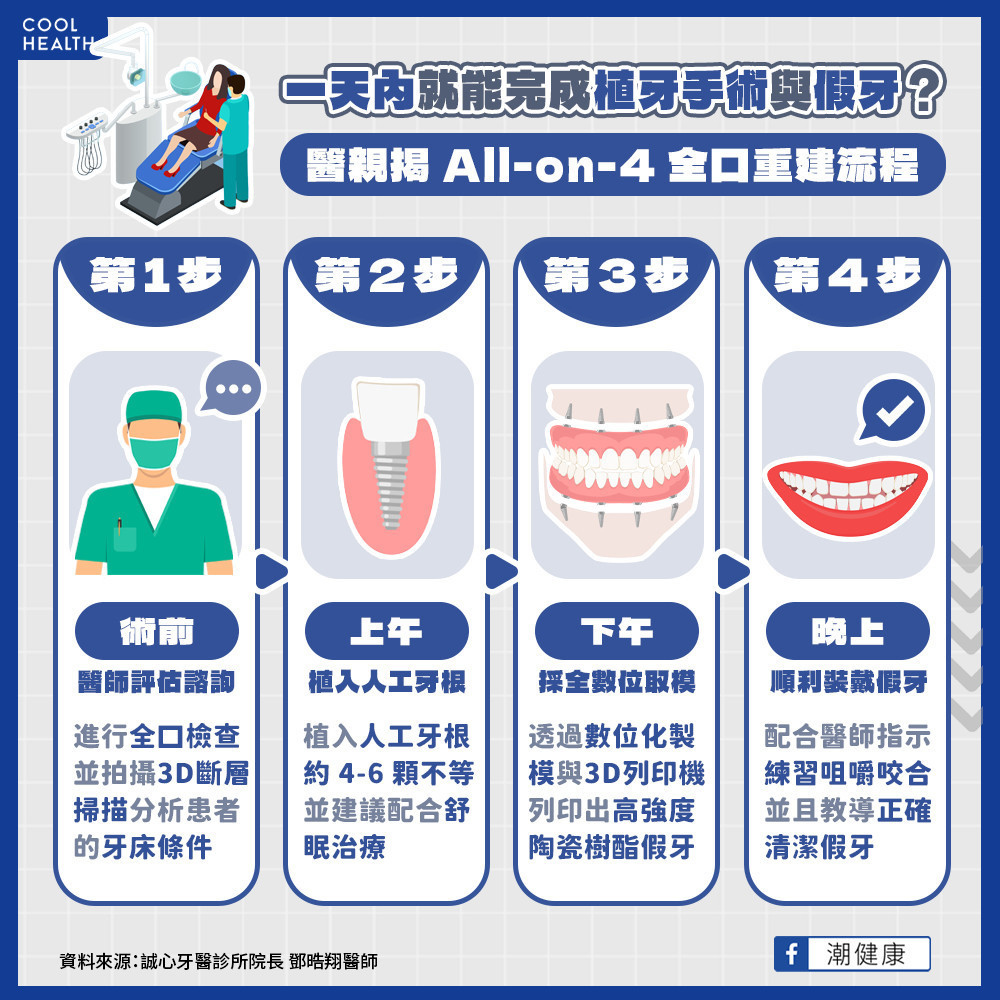 全口重建的最新技術？ 一天內就能完成植牙手術與假牙？