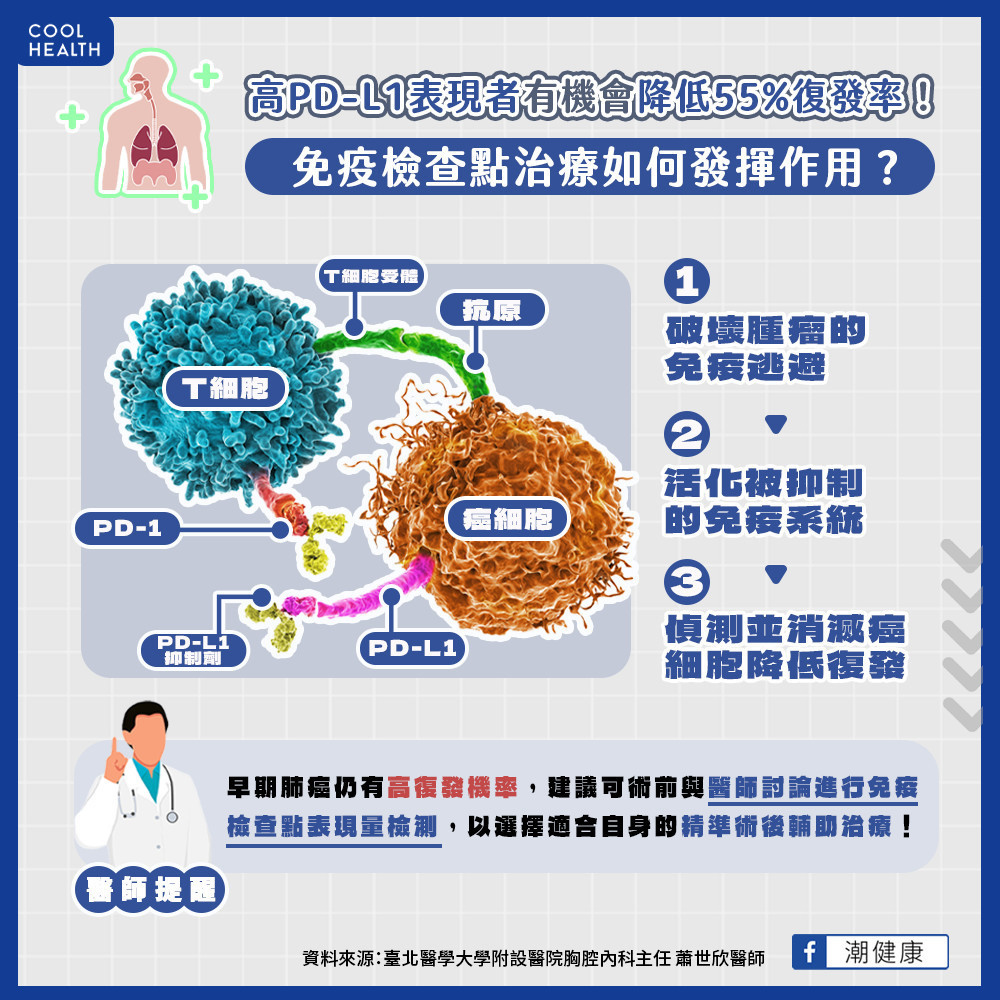 第2、3期患者3-6成恐2年內復發！  手術後輔助治療是早期肺癌預後關鍵之一