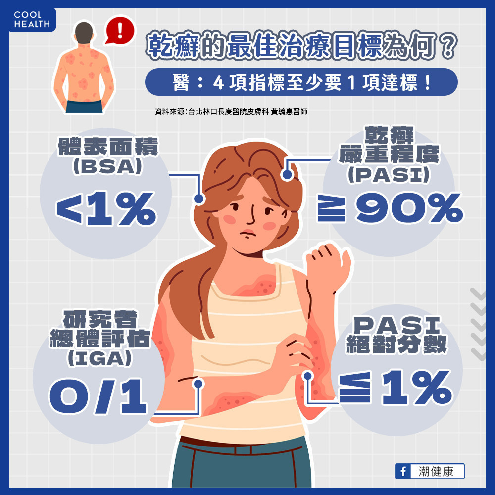 天冷乾癬病灶大爆發？  醫：及早達到最佳治療目標