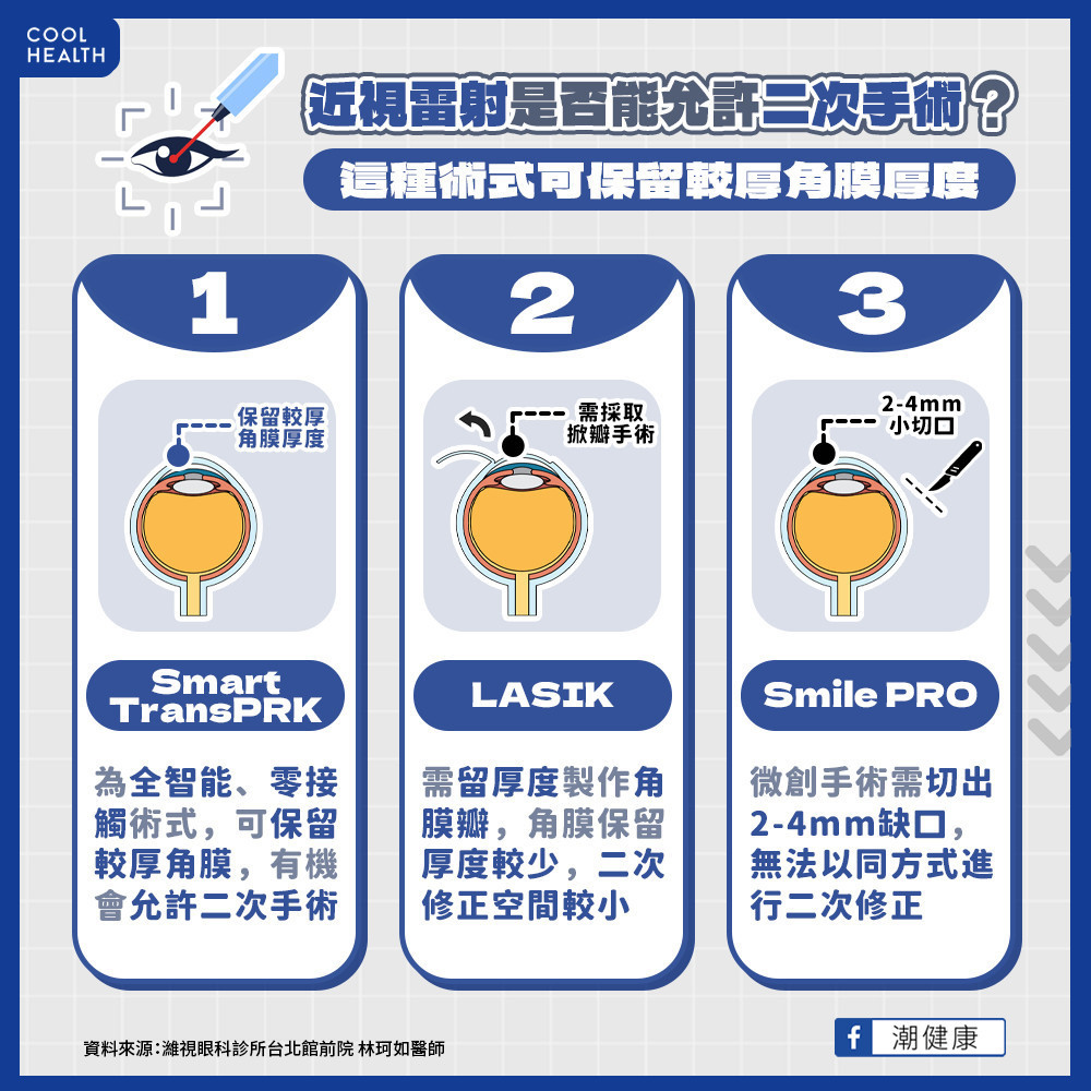 近視雷射想「回頭」進行可以嗎？ 第二次手術的成功機會差很大？