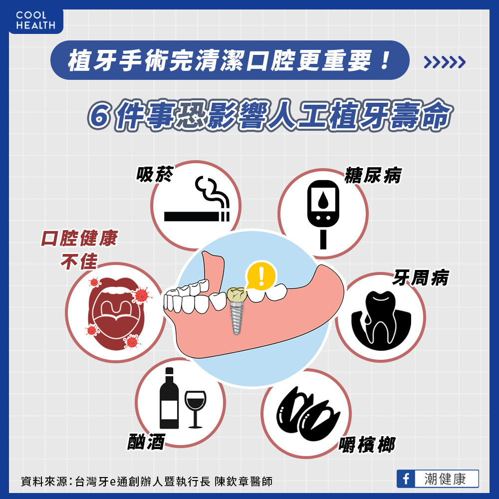 植牙完清潔更重要？  如何挑選植牙醫師？