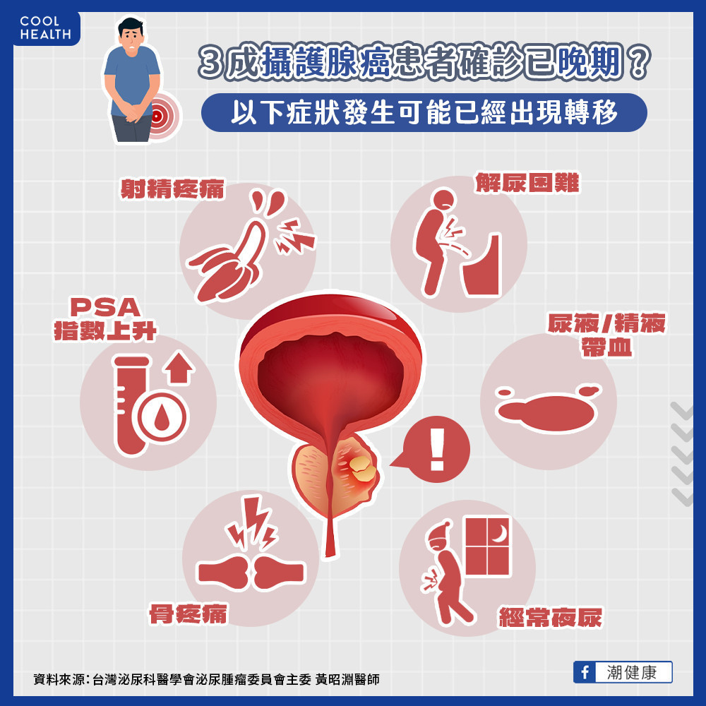 台灣攝護腺癌確診晚期  高出歐美國家近3倍