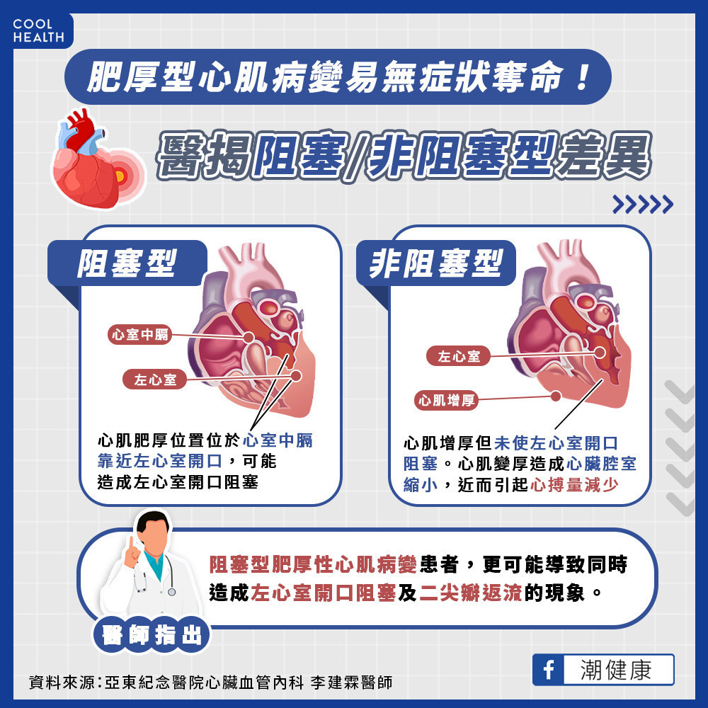 有50%機率會遺傳給下一代！ 什麼是「肥厚型心肌病變」？