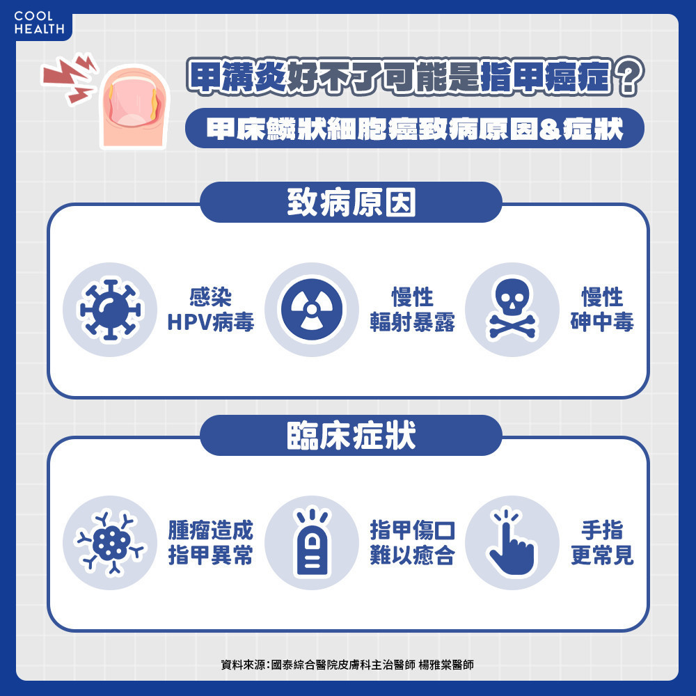 甲床鱗狀細胞癌的好發族群？ 致病原因與感染「這病毒」有關