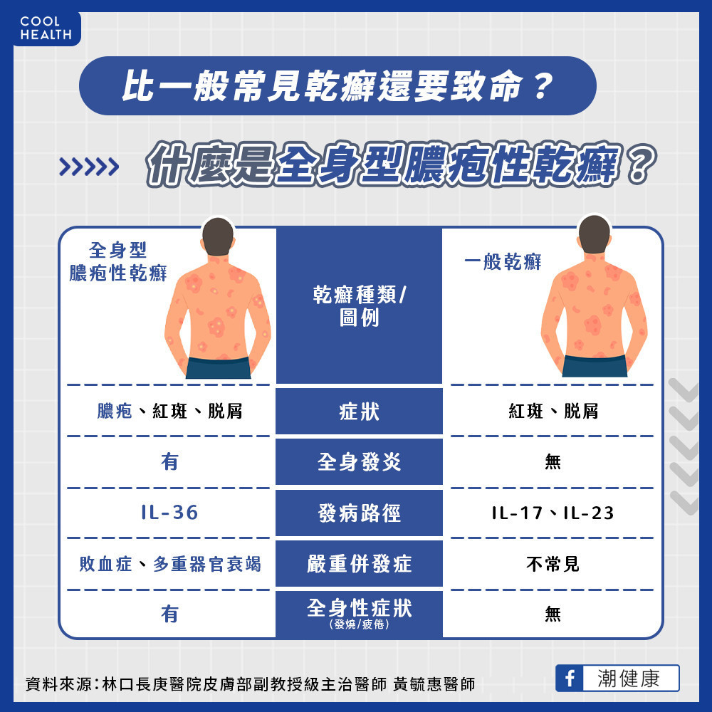 皮膚重症GPP恐伴致命併發症  台病友每10人有3人延遲半年診斷