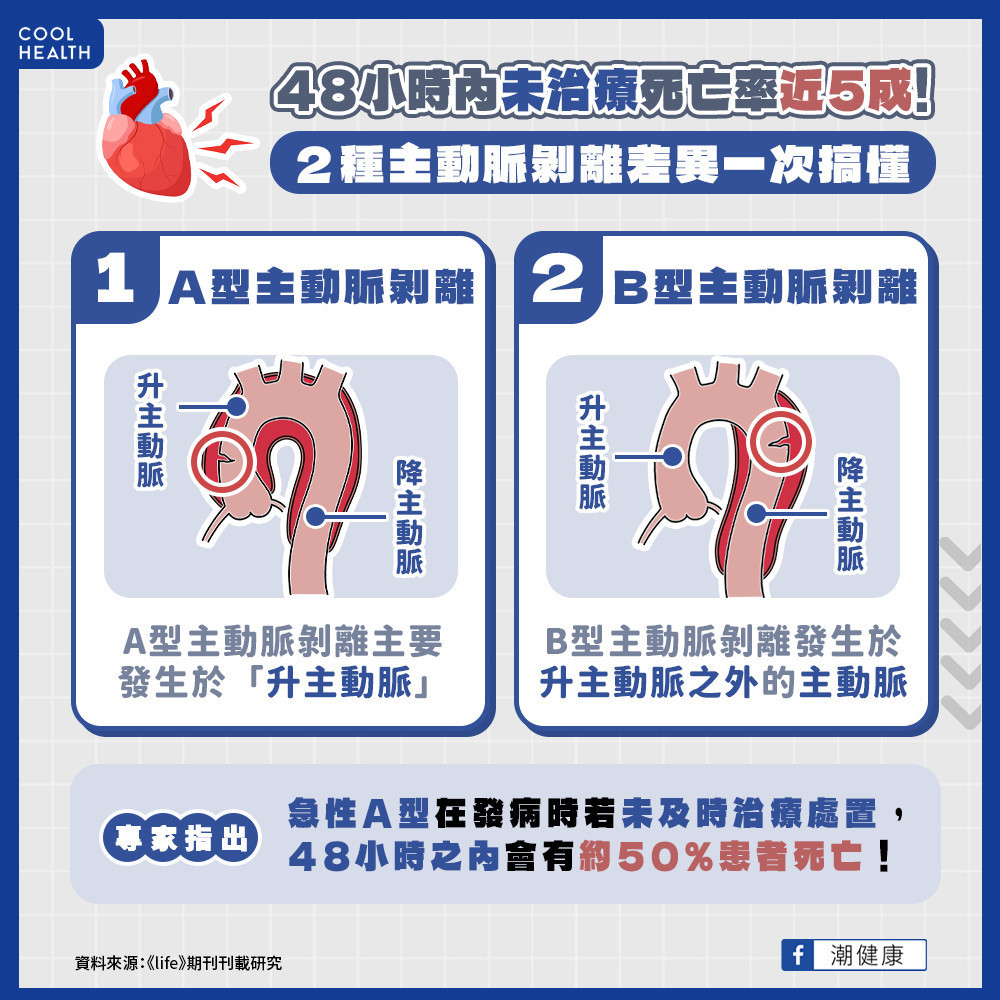 胸痛、背痛冒冷汗莫輕忽  主動脈剝離48小時內死亡率近5成