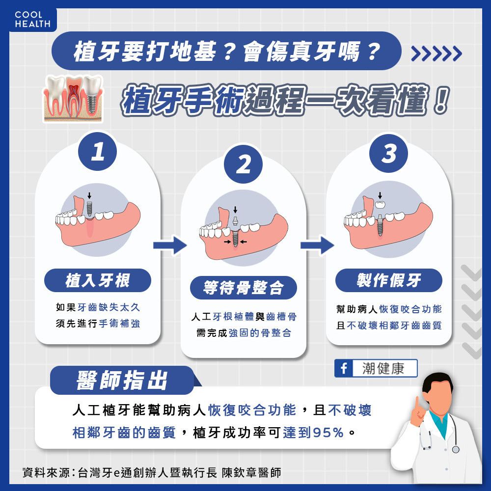 植牙手術是什麼？  植牙前需要打地基？